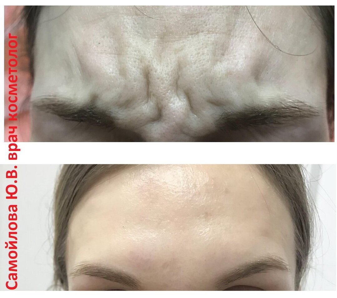 Источник: https://www.instagram.com/samoilova_md/?hl=ru