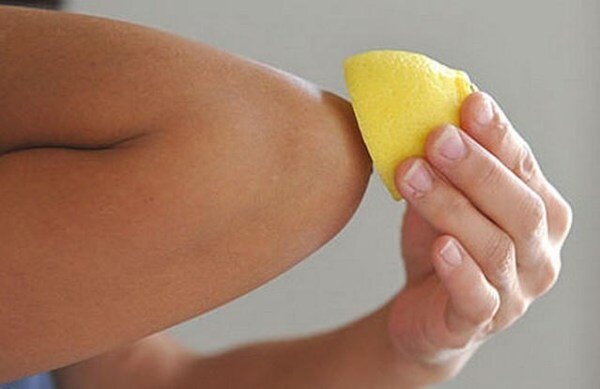 
В любом случае, первое, что советуют эксперты — попробуйте защитить кожу локтей кремом.