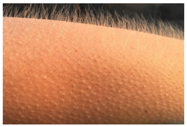 ФРИССОН - озноб или мурашки во время прослушивания любимой или прекрасной музыки.