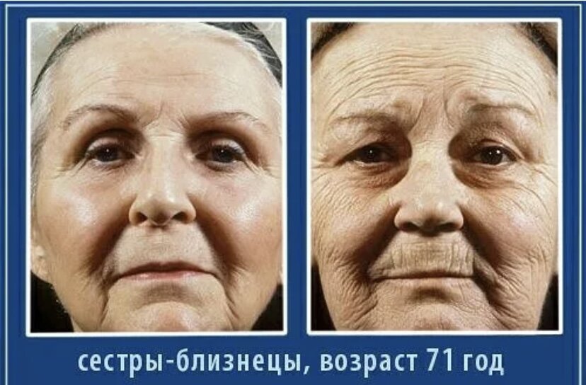 Одна из сестер использовала солнцезащитное средство, а другая сестра нет, разница очевидна 