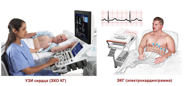 Что лучше ЭКГ или УЗИ сердца и чем они отличаются..