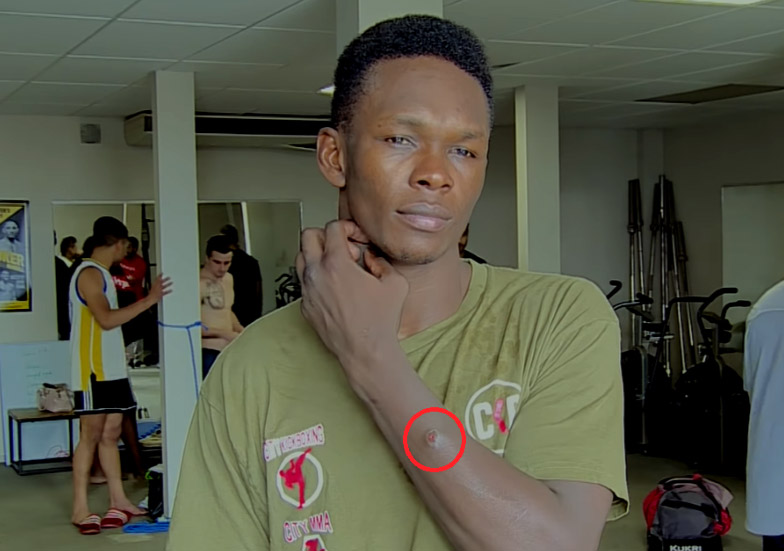 Исраэль Адесанья