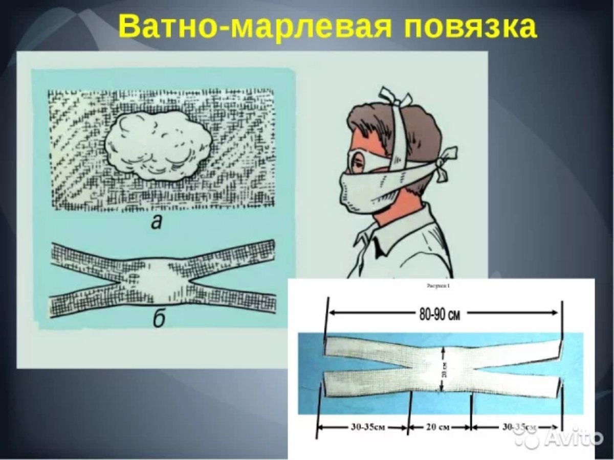 Марлевая повязка. Ватно марлевая повязка ОБЖ. Ватно марлевая повязка 15 на 20. Изготовить ватно-марлевую повязку ОБЖ. Ватно марлевая повязка из бинта.