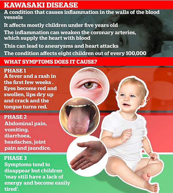 Болезнь до России не дошла, поэтому описания на английском, но суть ясна.
