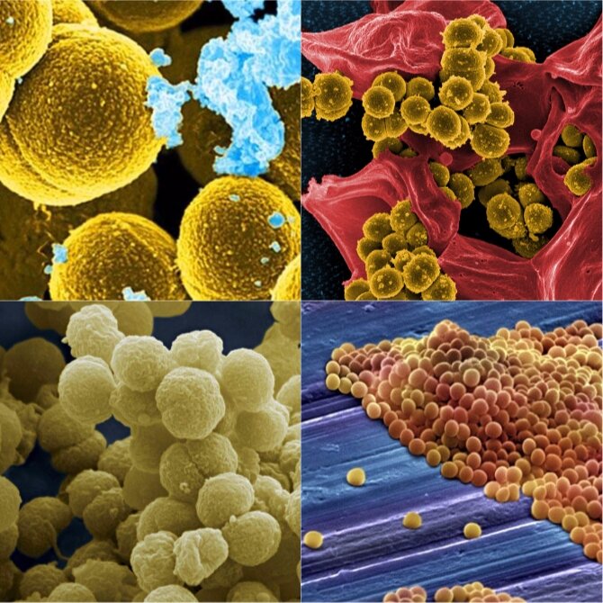 Золотистый стафилококк