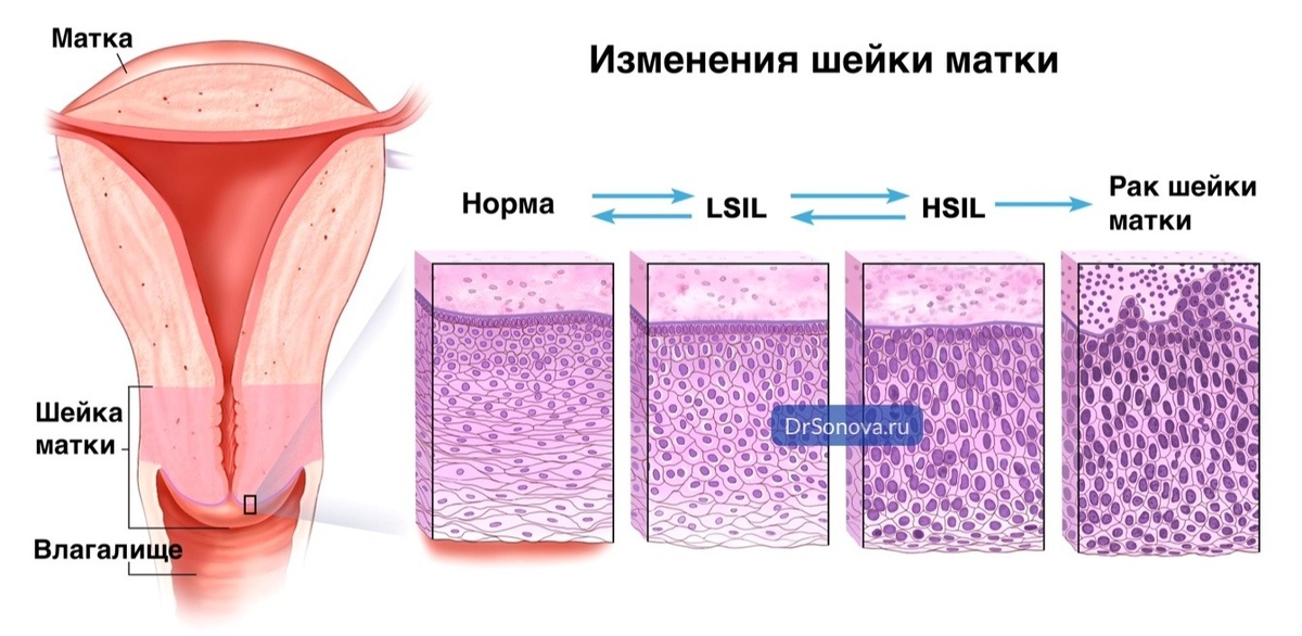 Женская репродуктивная система — Википедия