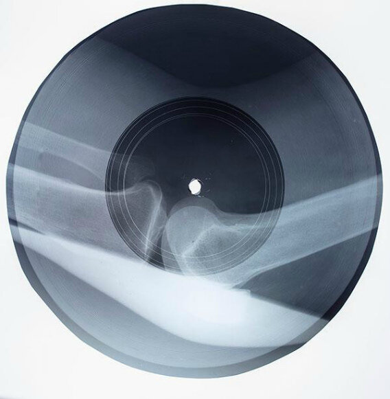 релиз на рентгеновском снимке