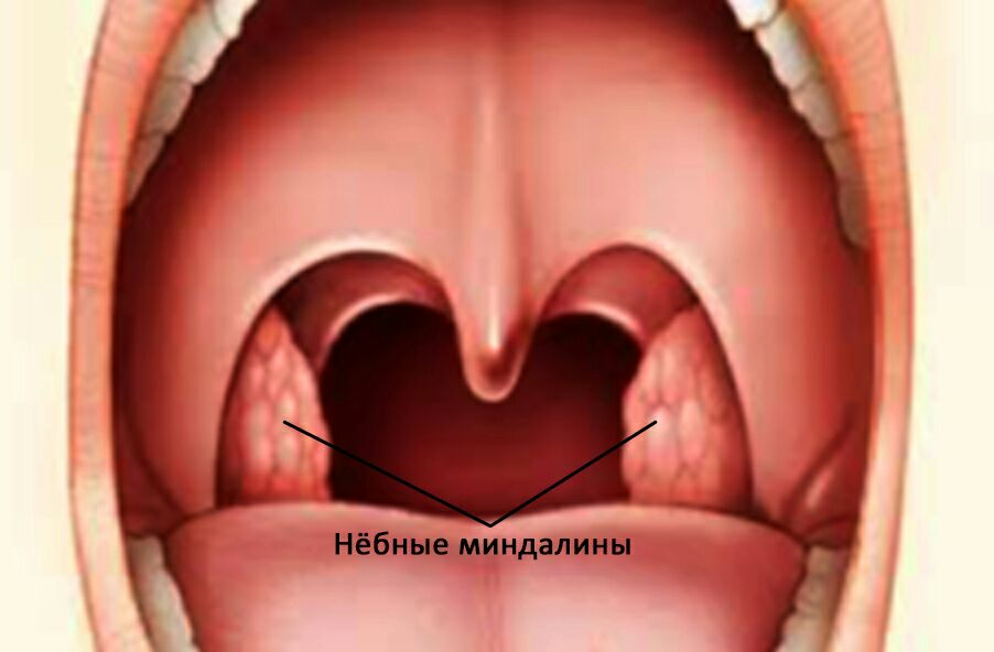 Источник: https://bronkhi.ru