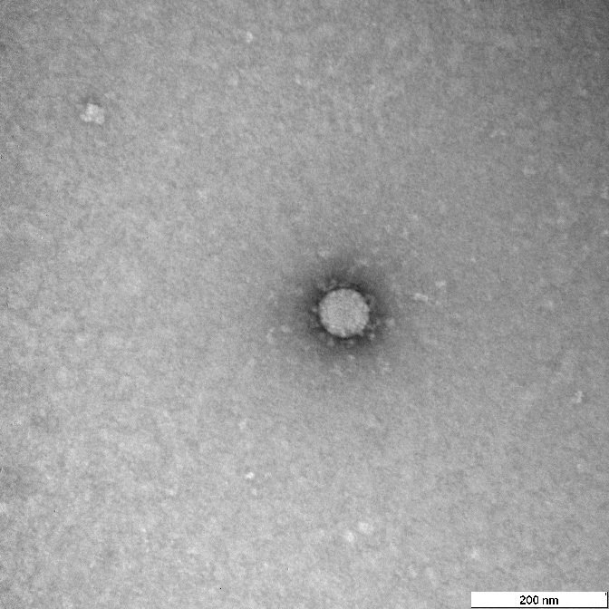 Коронавирус под микроскопом 