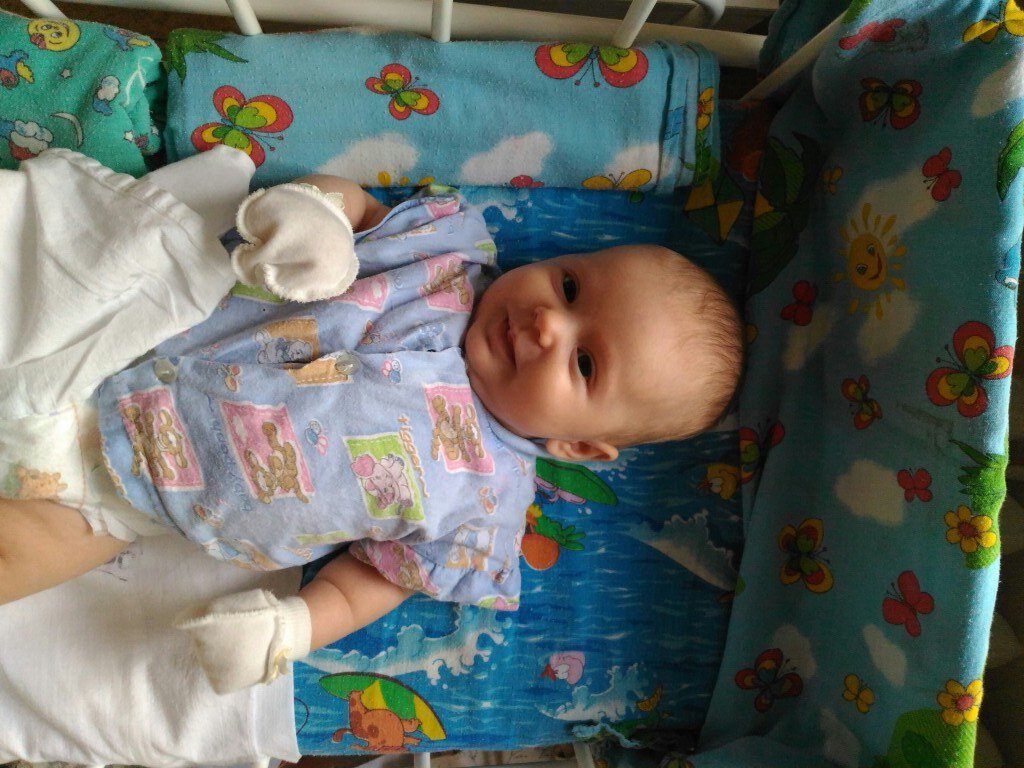 Улыбашка в патологии новорождённых. Фото: личный архив