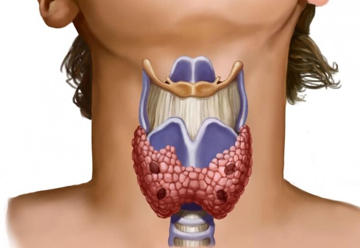 Щитовидная железа