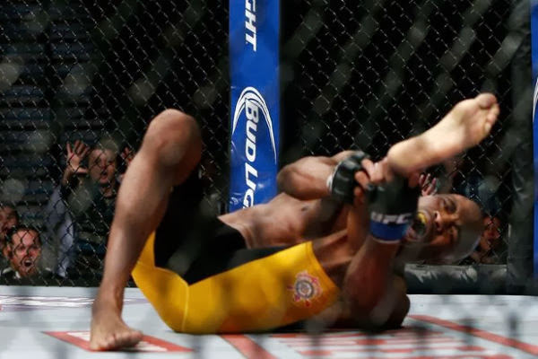 Картинка 1. Перелом ноги Андерсона Сильвы