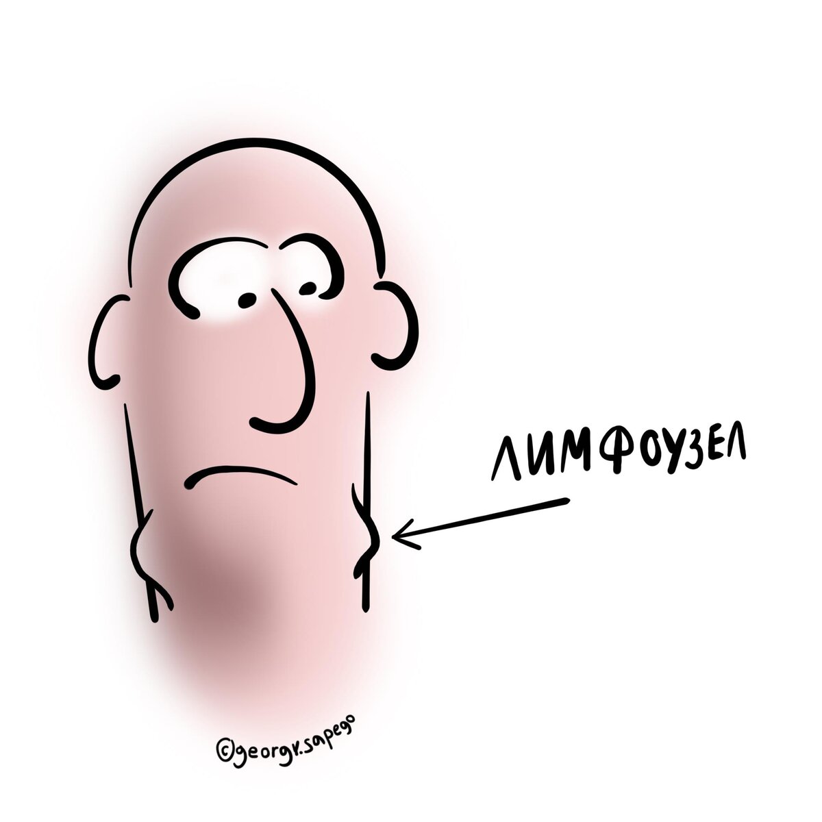 Лимфоузлы на шее