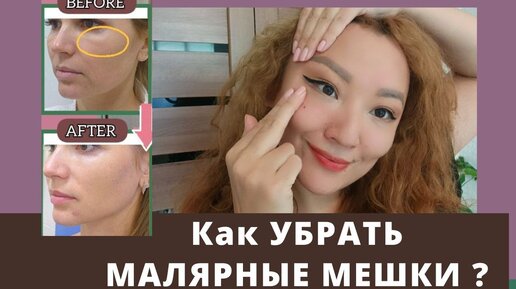 Как убрать мешки под глазами в домашних условиях? | Новости бьюти индустрии от Evitastore