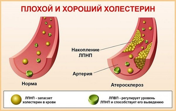 Холестерин на коже как выглядит Вот как обнаружить ВЫСОКИЙ ХОЛЕСТЕРИН! Методы снижения ХОЛЕСТЕРИНА YouTube Леч