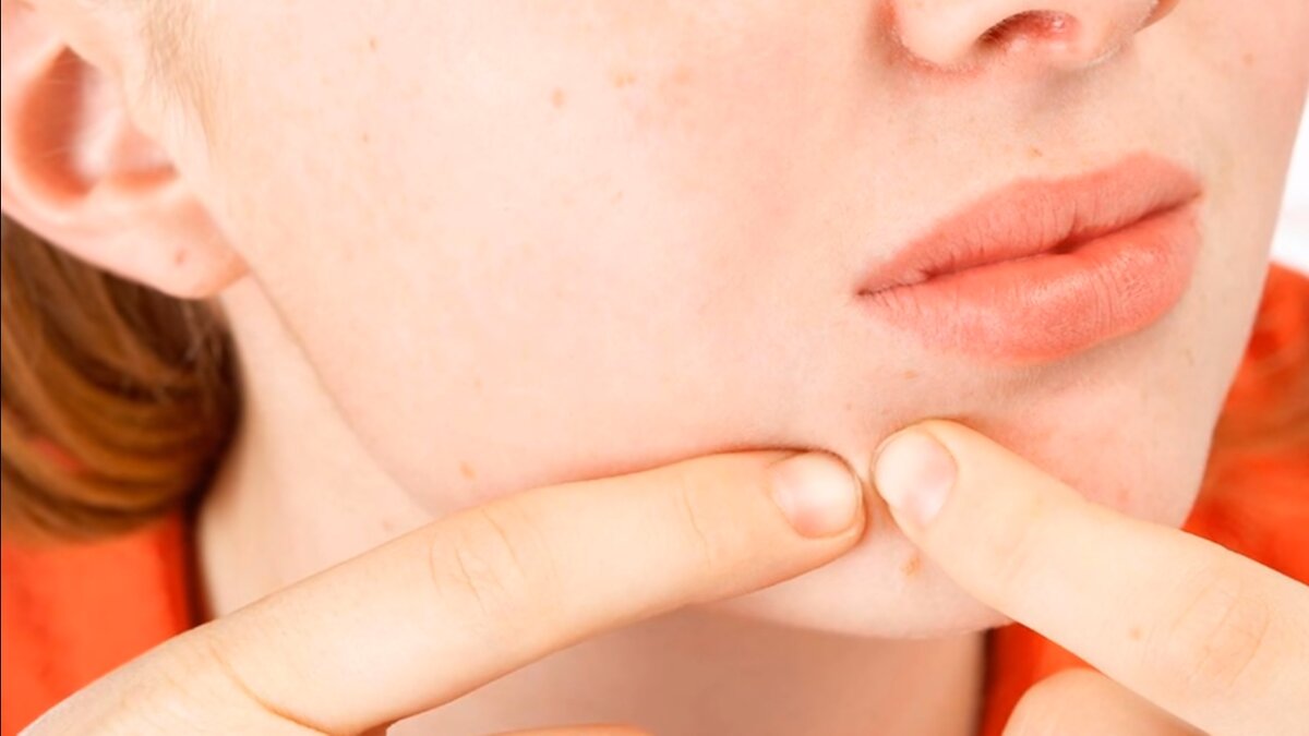 Гладкая, чистая, сияющая здоровьем кожа, без признаков преждевременного старения – и вы выглядите молодо, бодро, свежо! Ведь ничто так не привлекает внимания, как природная красота! Если это еще пока не про вас, значит, вам необходима чистка лица, которую можно сделать и дома.
