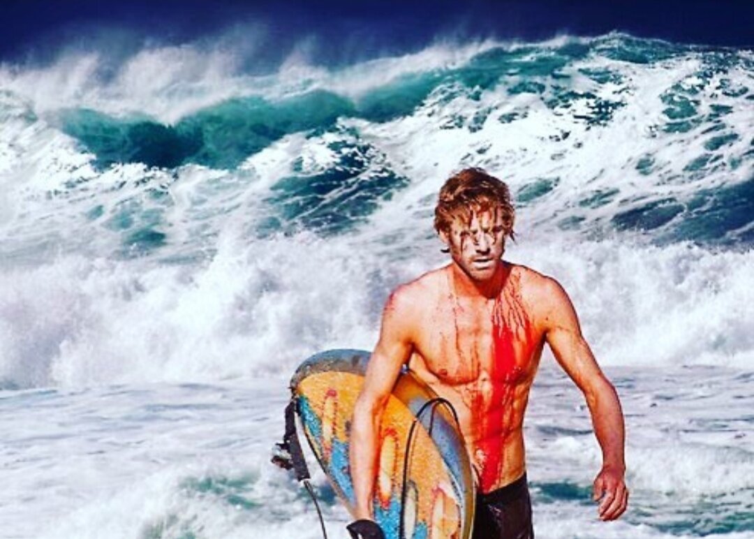 Серф травмы