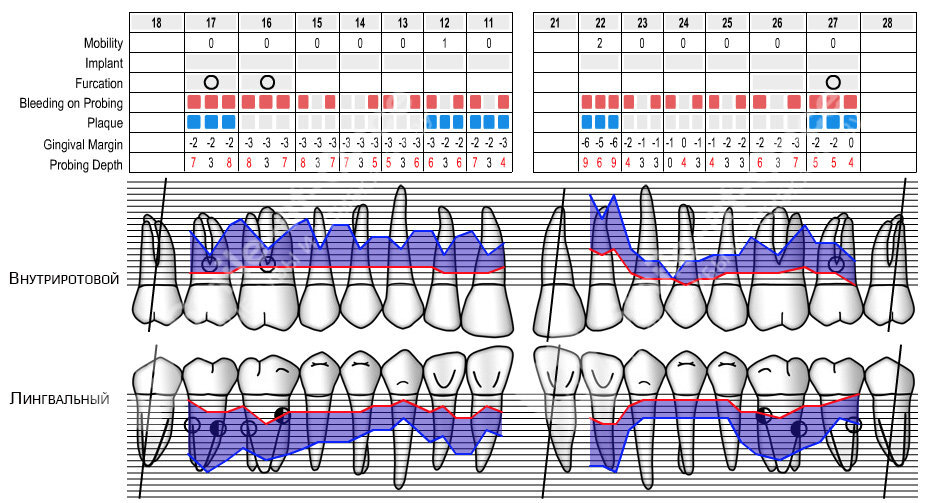 Пародонтологическая карта стоматологического больного