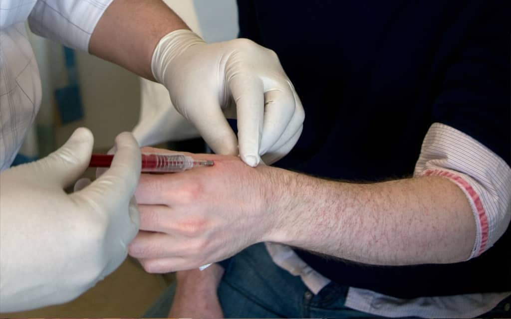  Введение чипа под кожу человека 