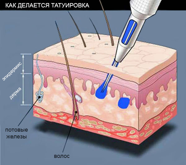 Последствия неправильного ухода за тату