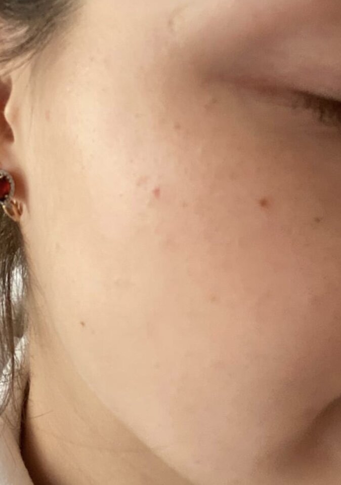 После 3х дней использования корейской косметики