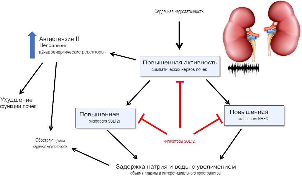 Принципы лечения сердечной недостаточности. Левожелудочковая сердечная недостаточность. Левожелудочковая недостаточность картинки. Лечение левожелудочковой недостаточности.