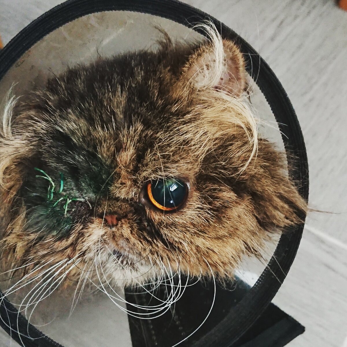 На фотографии уже снят дренаж,  конечно сразу после операции все это выглядело намного ужасней.