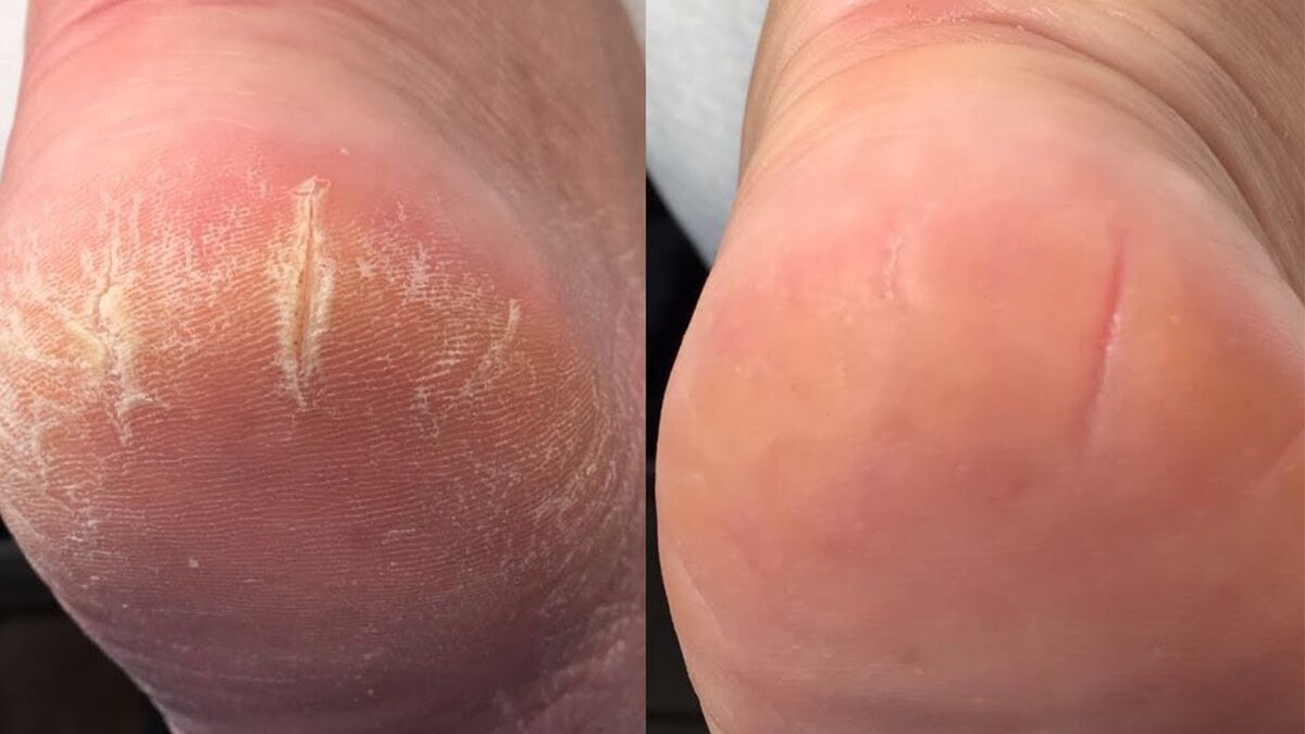 Источник: https://i.ytimg.com