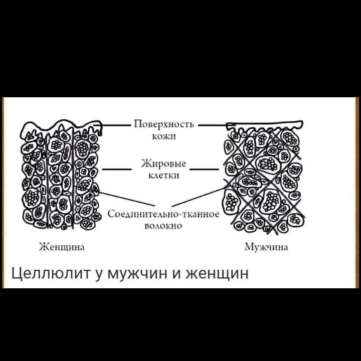 Целлюлит-НЕ КРИМИНАЛ! | Ксения Коновцева | Дзен