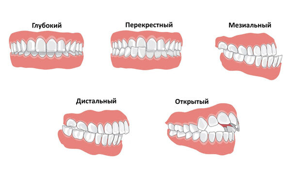 Взято из открытого источника Яндекс-картинки 