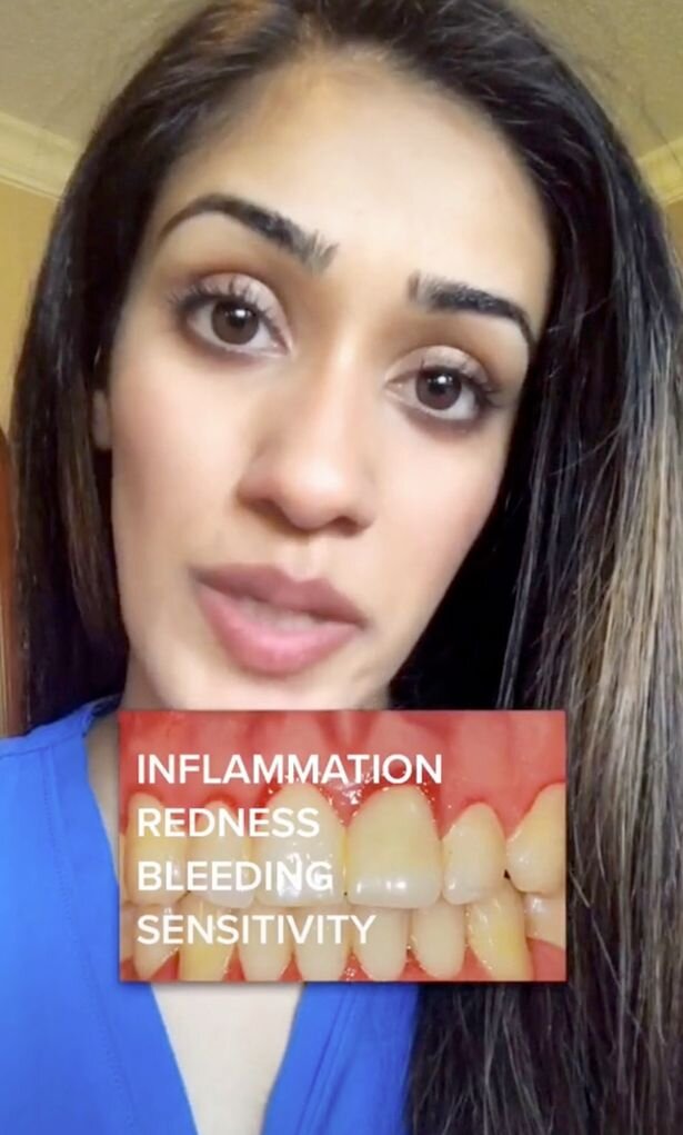 Фото взято из TikTok: thatdentalgal_