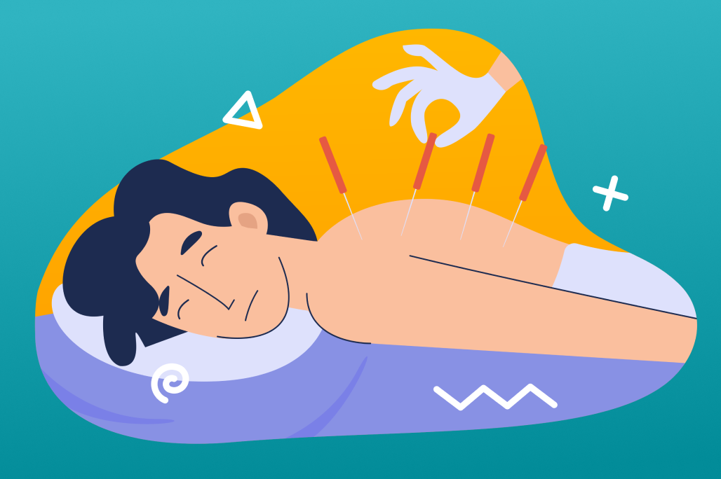 Иглоукалывание не повышает шансы на зачатие: результаты нового исследования