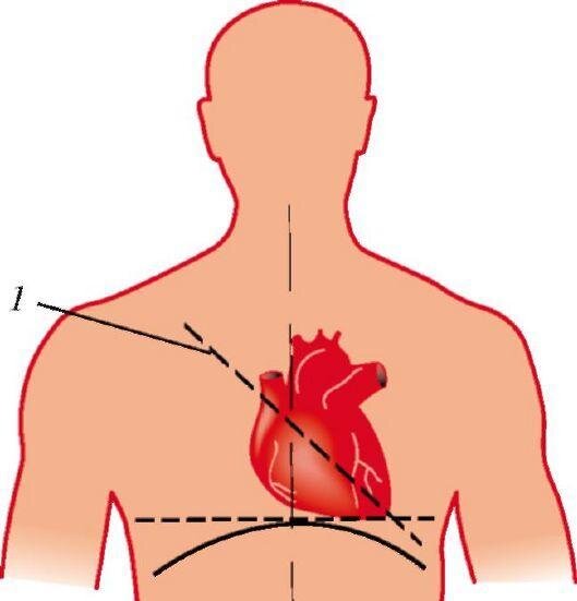 Кардиолог Яковлева: как понять, что болит именно сердце