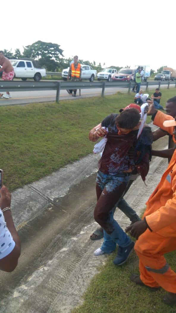 Как отметил Евдокимов, одной из пострадавших россиянок пришлось ампутировать обе руки. Издание «Регион online» утверждает, что это 12-летняя девочка, сообщает Газета RU