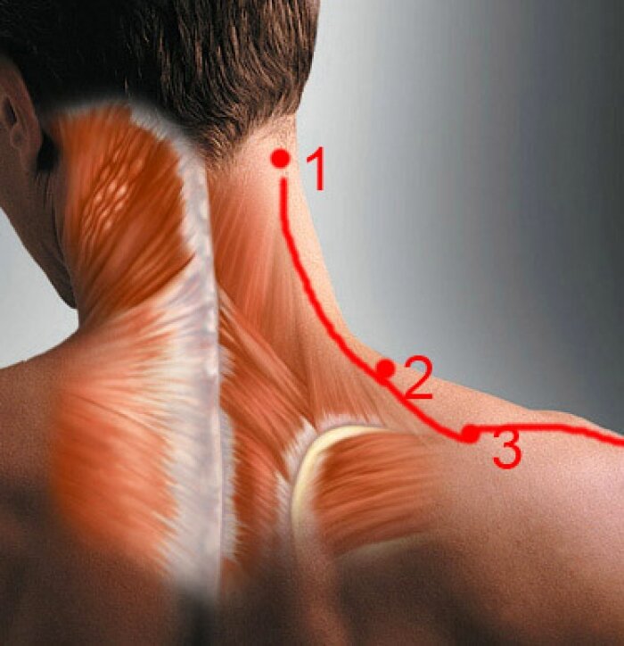 Как лечить растяжение мышц шеи, причины, симптомы в Москве