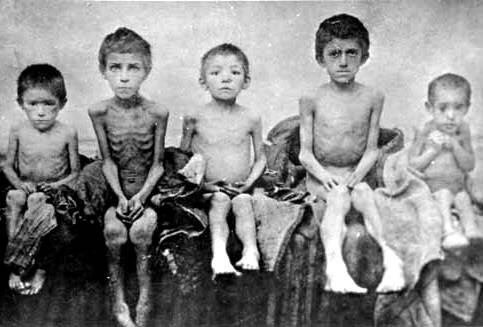 Голодающие дети. Фото 1930-е гг.