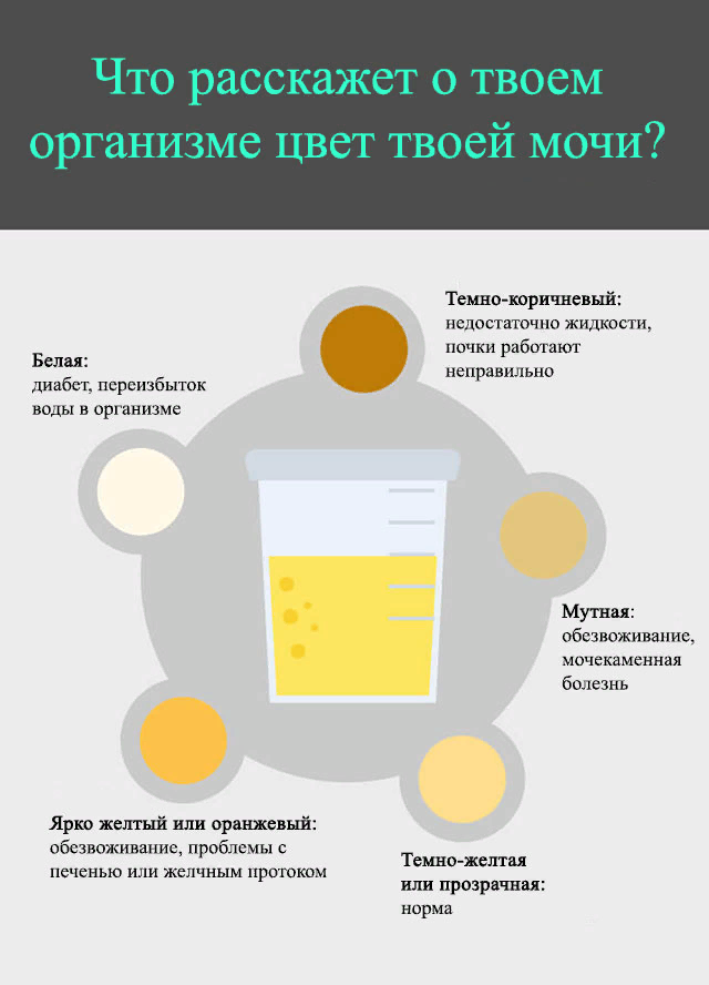 Нормальный цвет. Цвет мочи. Изменение цвета мочи. Цвет мочи при сахарном диабете. Моча тёмнгжёллого цвета.