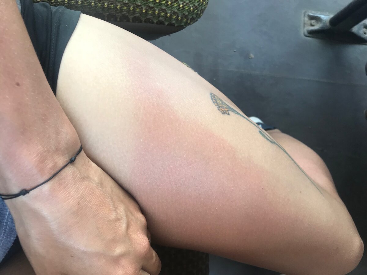 Прервёмся. Мой восхитительный загар.