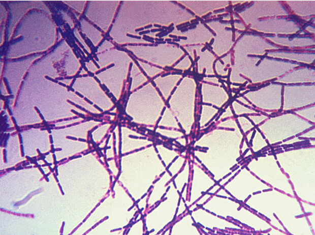 Вирус сибирской язвы под микроскопом