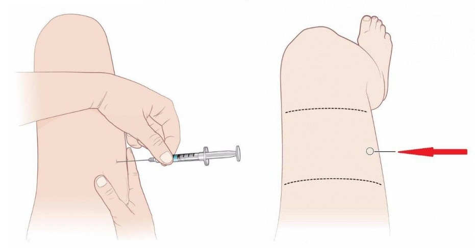 Источник: andrologmed.ru