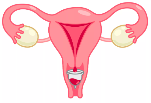 Как работает менструальная чаша
