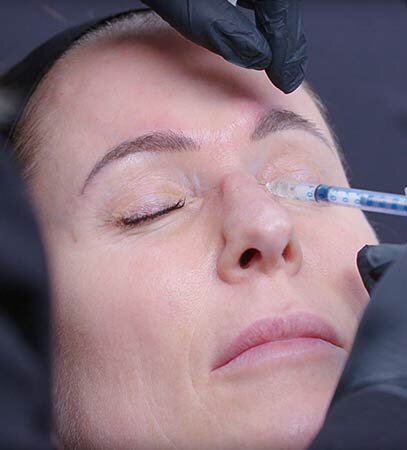 Тонкие линии и морщины на лице