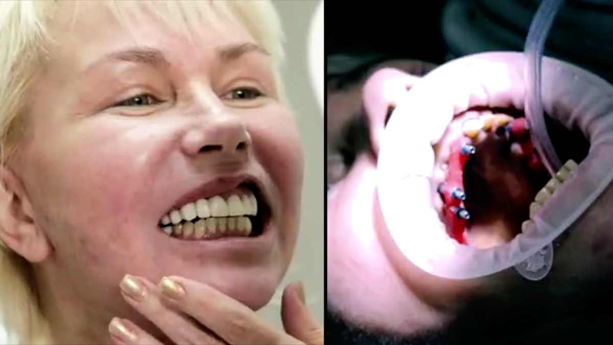 Фото: кадры программы "На 10 лет моложе. Выпуск от 30.07.2016»