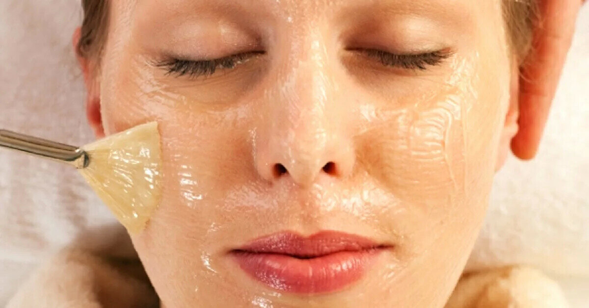 Процедуру нужно проводить очень аккуратно, чтобы не повредить кожу