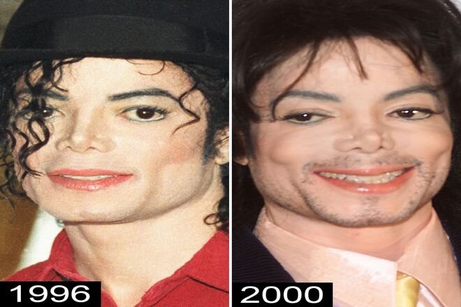 Подруга Майкла Джексона объяснила, почему певец сменил цвет кожи: «Он был болен» | STARHIT