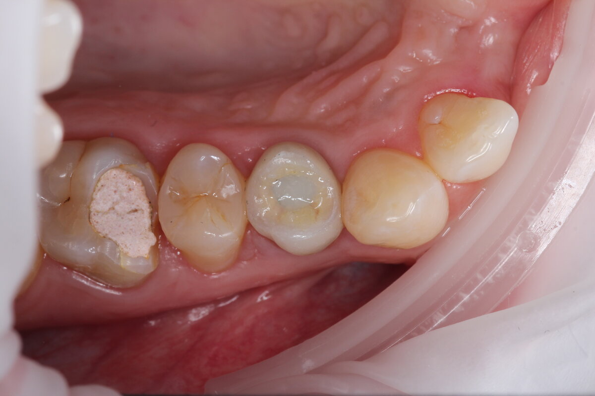 вид, после окончательной реставрации