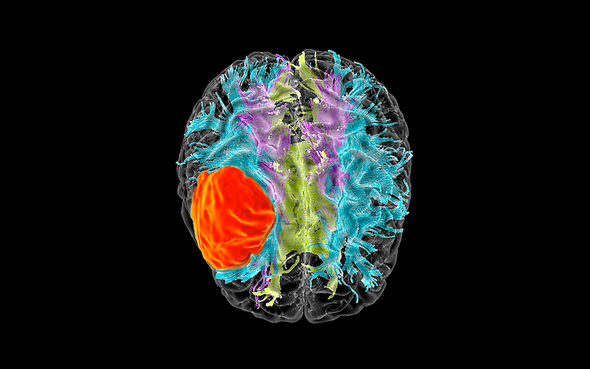 Фото:  ZEPHYR / SCIENCE PHOTO LIBRARY 