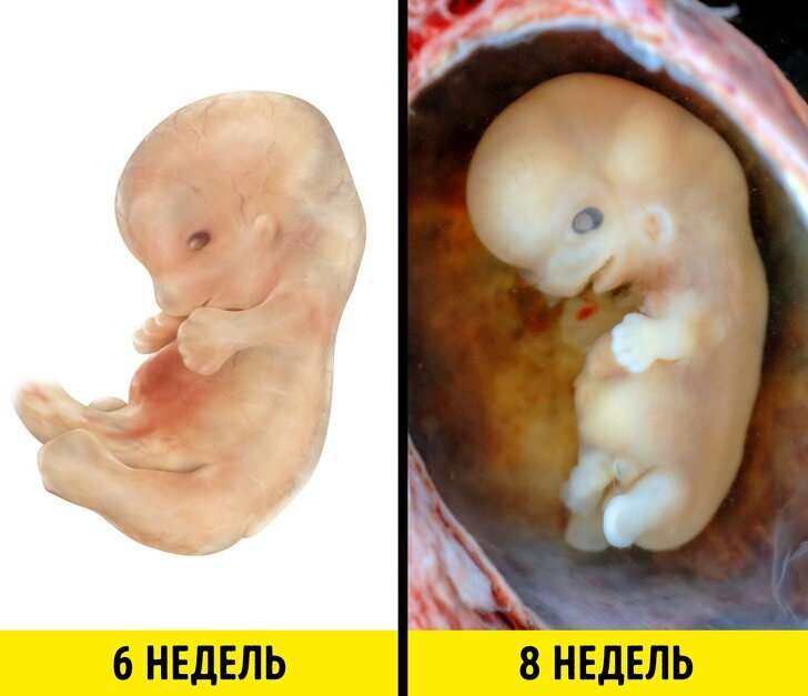 Я кстати выглядел моложе своего возраста и в 8 недель выглядел на 6!