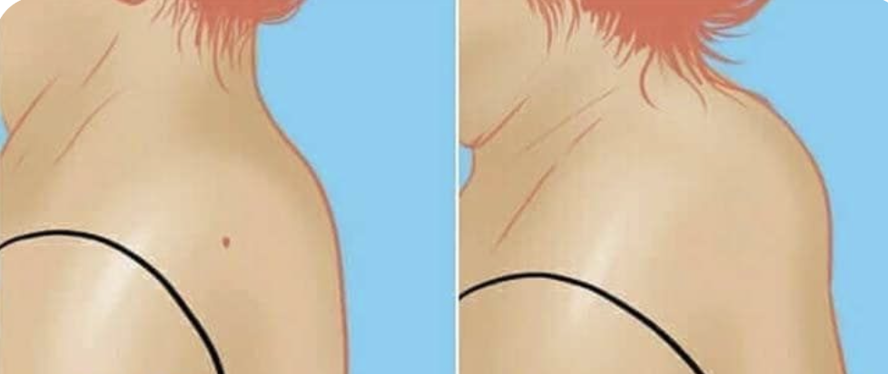 Холка, или вдовий горбик, - это самый настоящий механизм выживания. Фото: Пинтерест