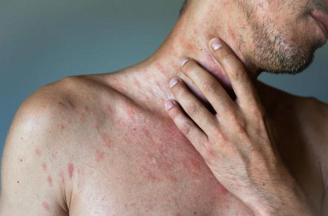 Фото: veganmed.org